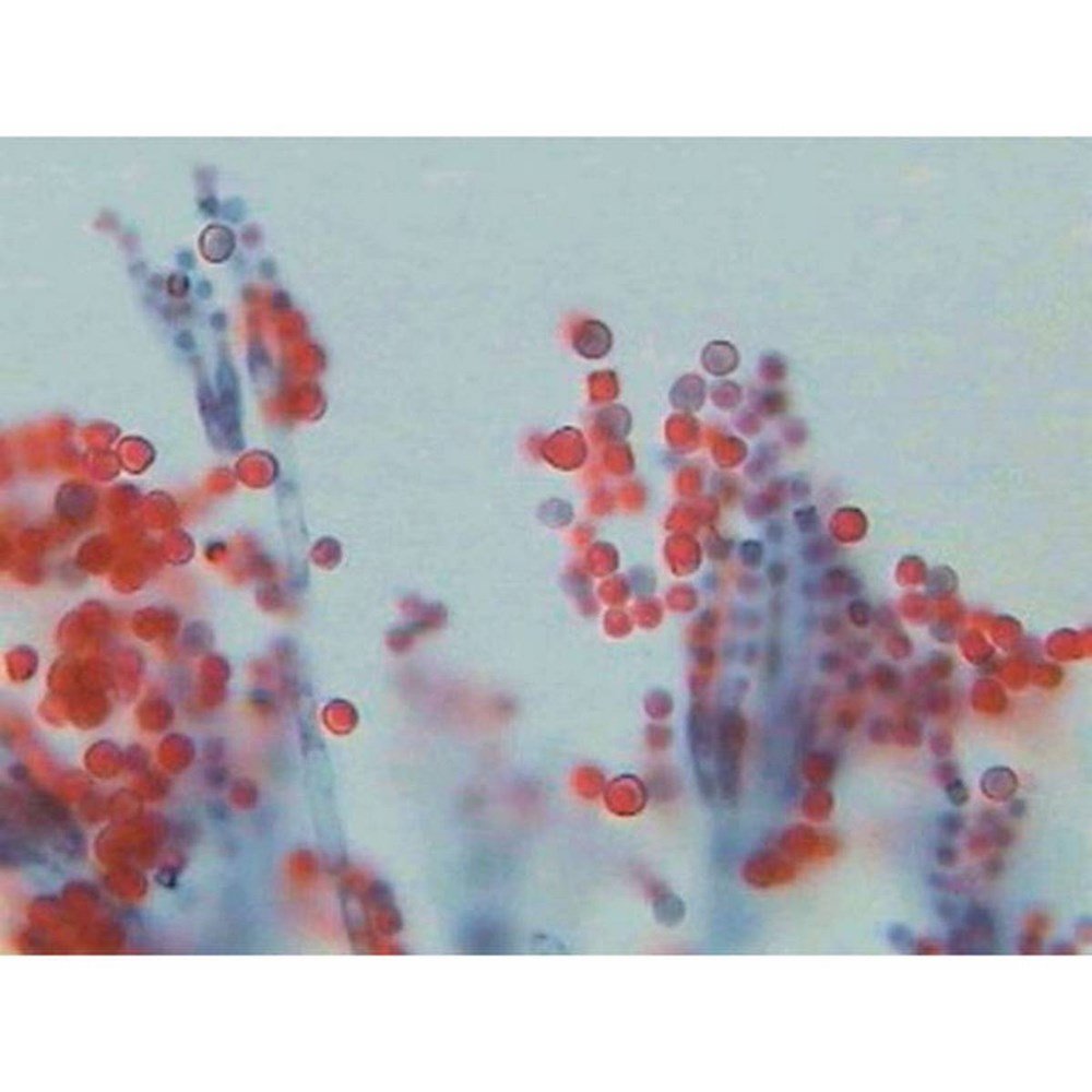Penicillium Section With Hyphae And - ABC School Supplies