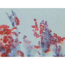 Penicillium Section With Hyphae And - ABC School Supplies