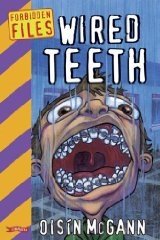 Wired Teeth (Forbidden Files) - ABC School Supplies